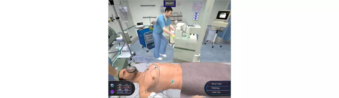 système Pulse